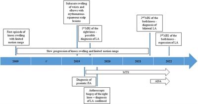 Successful use of adalimumab as a conservative treatment for bilateral knee lipoma arborescens in patient with psoriatic juvenile idiopathic arthritis – case report and review of literature